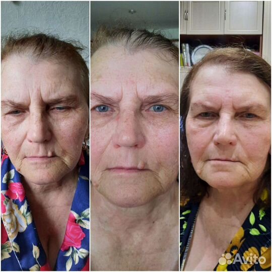 Массаж лица