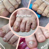 Подология, Зеленоград