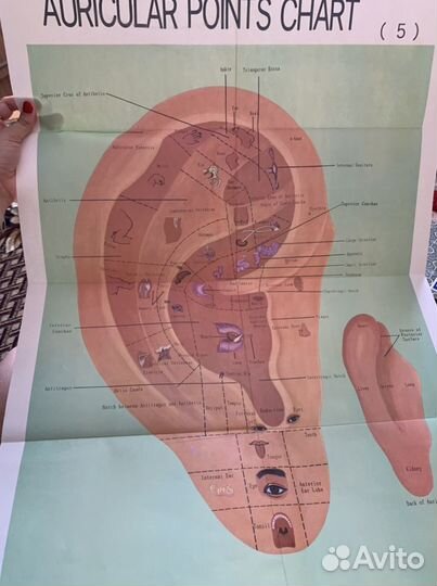 Набор для иглоукалывания