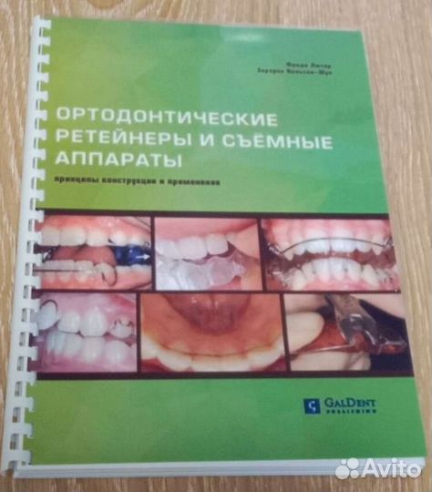 Книга Ортодонтические ретейнеры и съемные аппараты