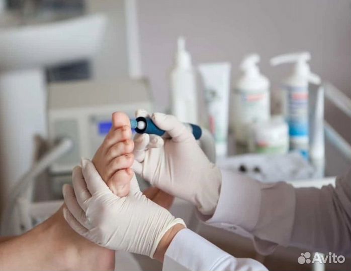 Медицинский педикюр