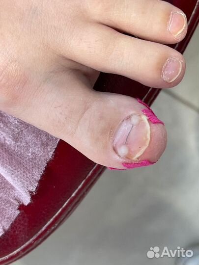 Услуги подолога