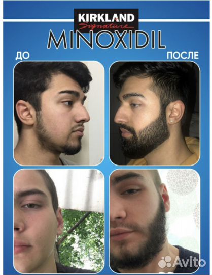 Миноксидил 15, Оригинал