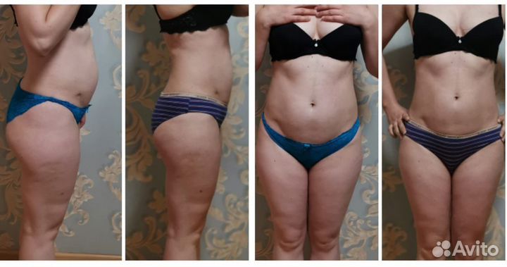 Массаж (коррекция фигуры) Только женщины