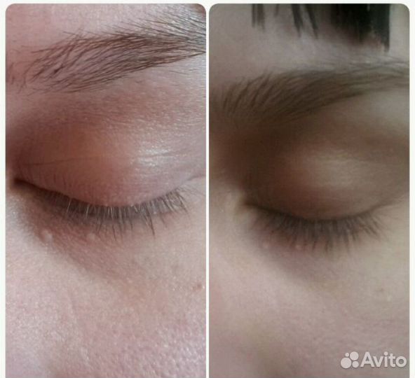 Средство для роста ресниц