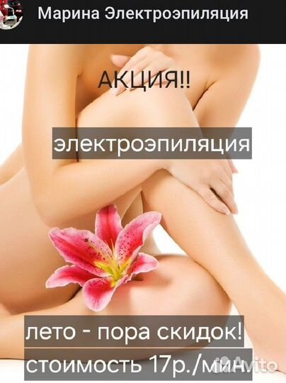 Электроэпиляция