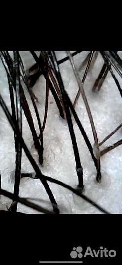 Спа пилинг для кожи головы