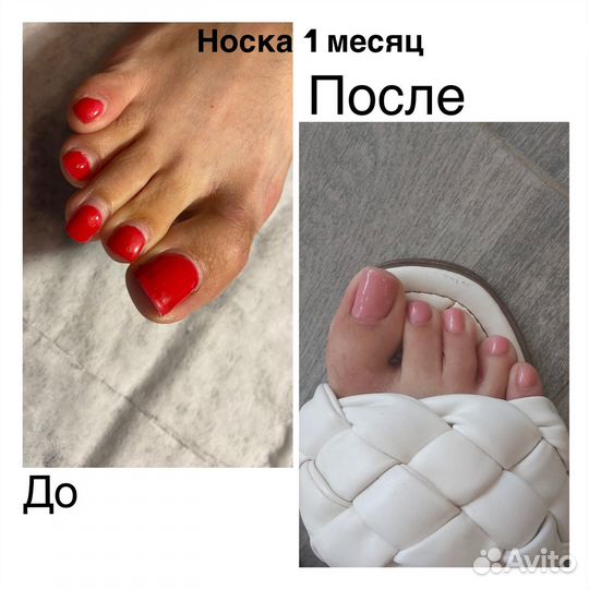 Можель на педикюр