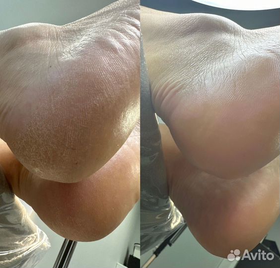 Маникюр,наращивание ногтей,педикюр