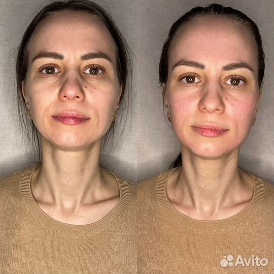 Миофасциальный массаж+Буккальный массаж