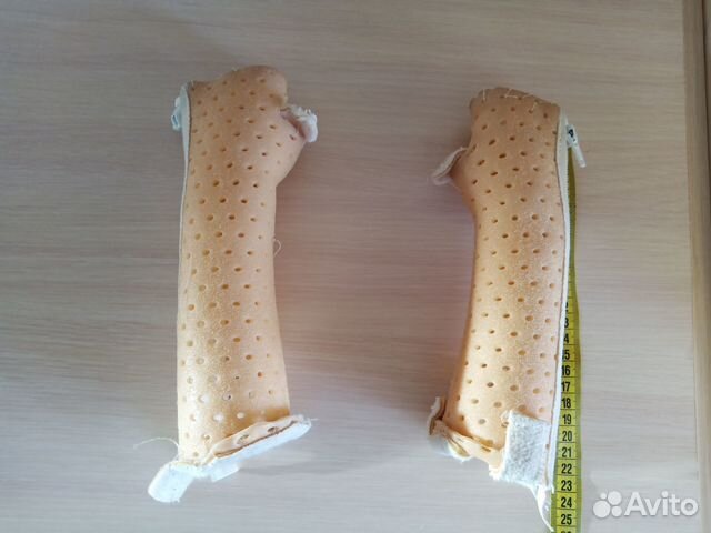 Тутор из турбокаста на лучезапястный сустав