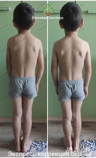 Массаж лица и тела. Остеокоррекция. Оздоровление