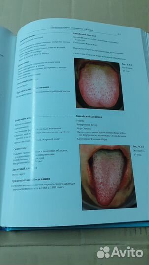Атлас Китайской диагностики по языку