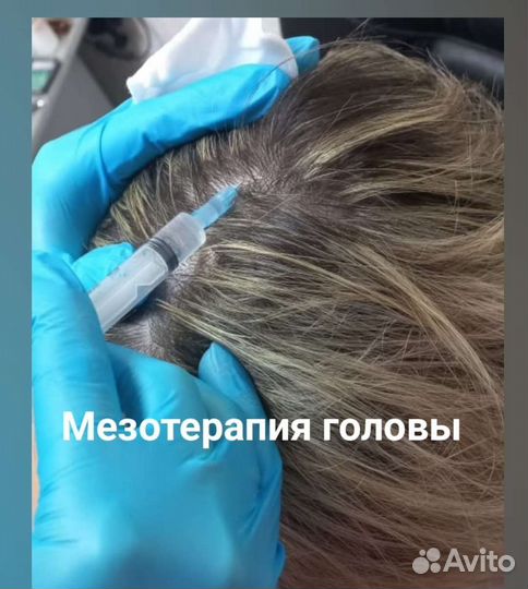 Косметолог. SMAS лифтинг