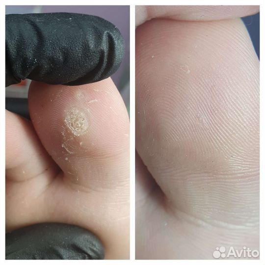 Подолог/ индивидуальные стельки