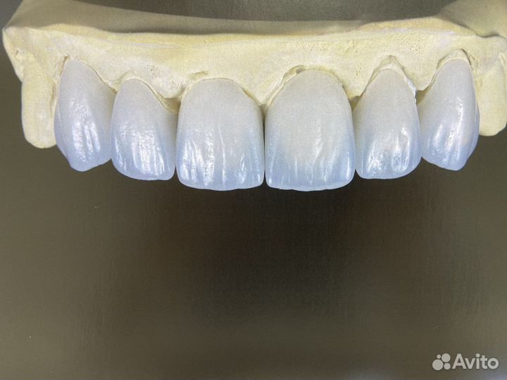 Протезирование