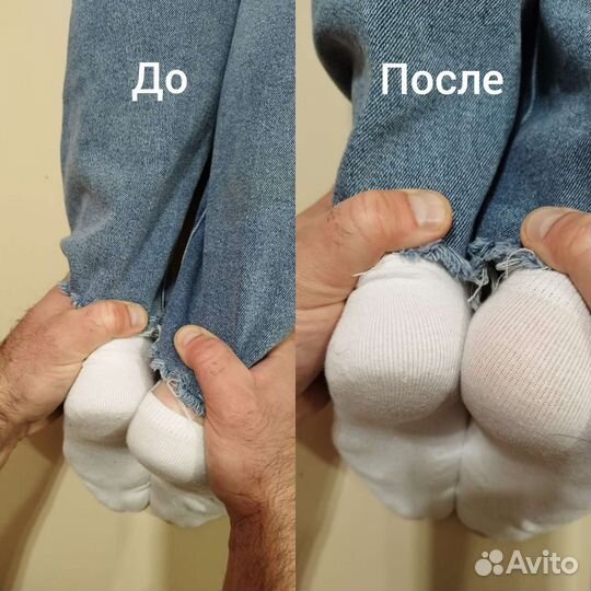 Костоправ/Правка Атланта